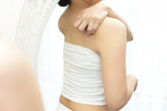 汗でかゆいのはあせも?かぶれ?症状を抑える対処法と自分でできる予防法