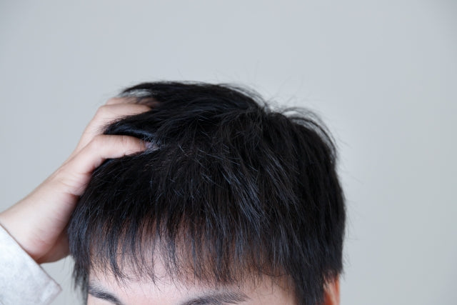 油っぽい頭皮で悩む男性必見！ベタつきの原因と簡単なケア方法をご紹介